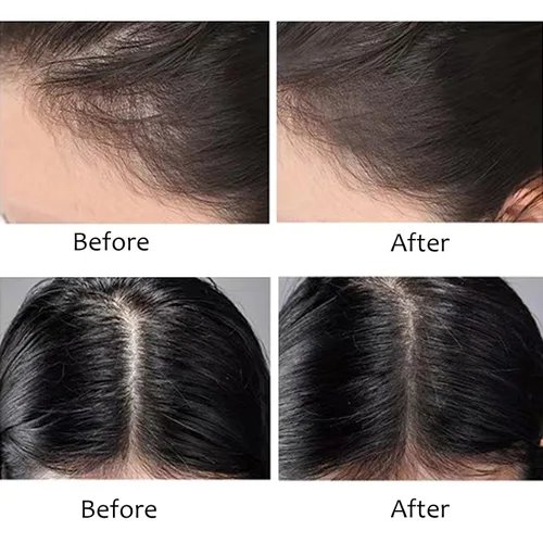 Miniatura 3 de Polvo en barra de línea capilar – Polvo de sombra de línea capilar oculta instantáneamente la pérdida de cabello, polvo de retoque de raíces Negro