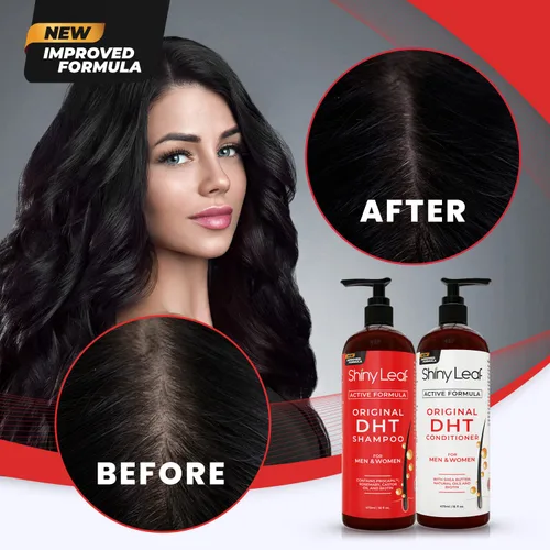 Miniatura 6 de DHT Blocker Champú y acondicionador - Para mujeres y hombres, fabricado en Estados Unidos, tratamiento contra la caída del cabello, con biotina