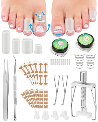Kit de eliminación de uñas encarnadas, tratamiento de uñas encarnadas, herramientas correctoras de uñas encarnadas vienen con soportes para uñas de