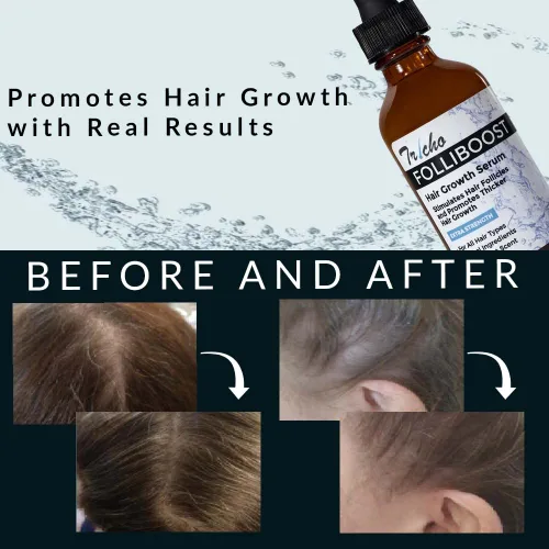 Miniatura 4 de Tricho Labs Folliboost - Suero para el crecimiento del cabello, fórmula de base natural con biotina y aceite de menta, cuidado del cabello para un