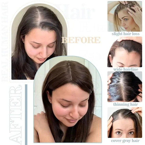 Miniatura 6 de S-noilite Toppers para el cabello para mujer, cabello humano real, base de encaje mejorado, toppers para mujeres con cabello delgado, piezas