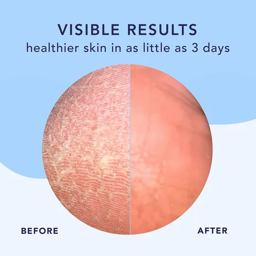 Miniatura 3 de Barefoot Scientist Crema de hidratación intensiva para terapia de pies de alta inmersión, humedad especializada para pies secos y talones agrietados