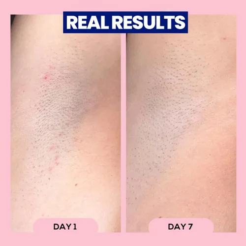 Miniatura 6 de Megababe Après Shave Después del afeitado y depilación Tratamiento roll-on para vellos encarnados y protuberancias de afeitado para mujeres