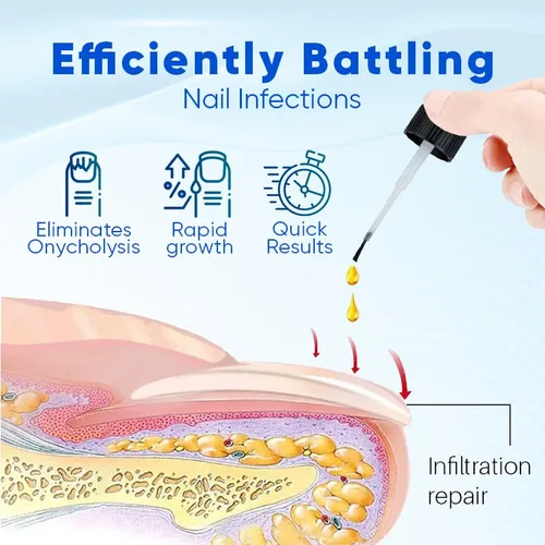 Miniatura 3 de OnyxoGuard - Suero de crecimiento y reparación de uñas, suero avanzado para el crecimiento de uñas, fortalecedor y crecimiento de uñas, revitaliza