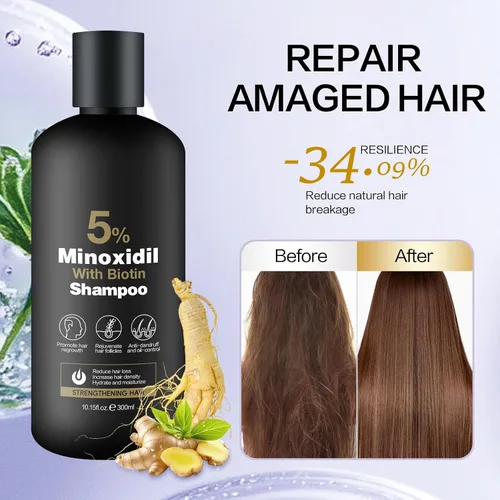 Miniatura 8 de Set de Champú y Acondicionador de Minoxidil para el Crecimiento del Cabello – Biotina, Ginseng y Jengibre – Apoya Cabello Más Grueso y Abundante
