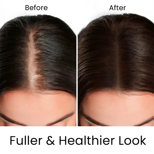Miniatura 4 de Moehair Champú Hair Guard de tamaño de viaje, apto para viajes, engrosamiento y volumen del cabello, infundido con aceite de argán, ginseng