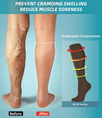 Miniatura 3 de FuelMeFoot Calcetines de compresión - 20-30mmHg Soporte graduado para hombres y mujeres, ideales para fútbol, correr y enfermeras