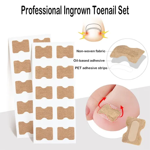Miniatura 5 de Juego profesional de uñas encarnadas con tiras transpirables de uñas encarnadas, tiras correctoras de uñas de los pies, parche corrector de uñas
