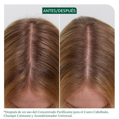 Miniatura 2 de Biolage Scalp Sync Universal Conditioner - Nourishing & Hydrating for All Scalp Types, Lightweight Moisturizing & Conditioning, Fermented Tea Blend