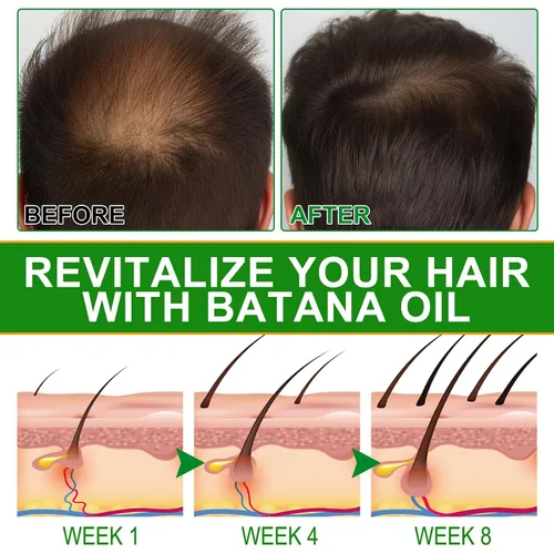 Miniatura 6 de Aceite de batana para el crecimiento y nutrición del cabello, masajeador de cuero cabelludo incluido, aceite puro y natural de Honduras