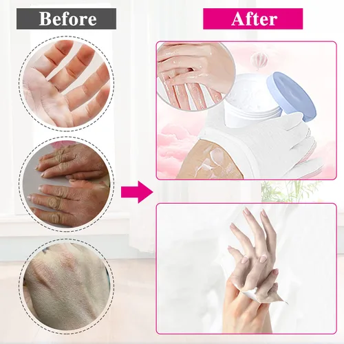 Miniatura 4 de 24 guantes hidratantes de algodón para mujeres y niños, manos secas y eczema, guantes de tela blanca reutilizables y elásticos