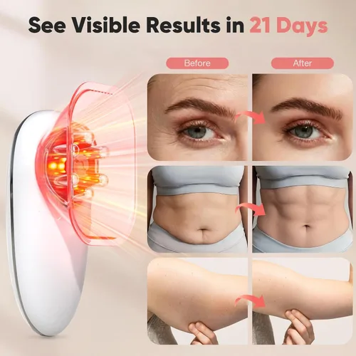 Miniatura 3 de Masajeador eléctrico de celulitis 3 en 1, máquina de esculpir el cuerpo con ventosas y terapia de calor, herramienta de ajuste manual inalámbrico