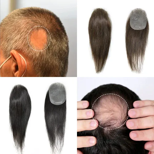 Parche para el cabello de piel ultra fina para hombres Unidad de reemplazo de cabello para puntos calvos Piel de aspecto natural Toupee Patch para