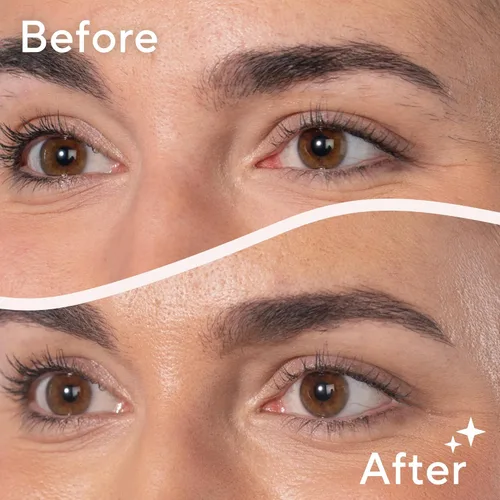 Miniatura 7 de Finishing Touch Flawless Removedor de pelos sueltos, herramienta de depilación de micro-hojas precisa, diseñada para cortar sin dolor pelos sueltos