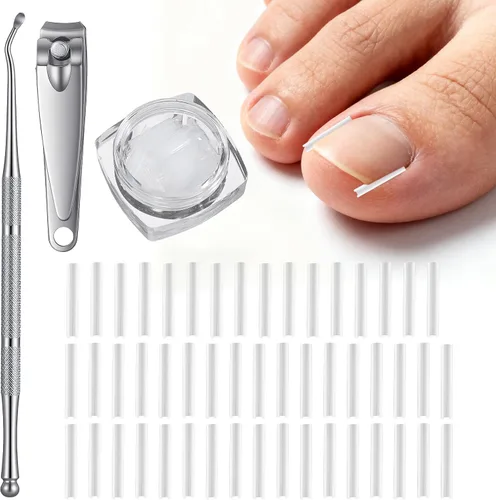 (50+2) Juego de corrector de uñas encarnadas con cortaúñas, kit profesional de eliminación de uñas encarnadas sin dolor con levantador, tira de uñas