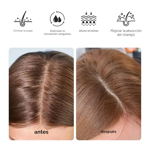Miniatura 6 de RHOS Masajeador de cuero cabelludo, cepillo de champú con asa, limpiador de cabello curvado y ventilado, cepillo para el cuero cabelludo para Azul