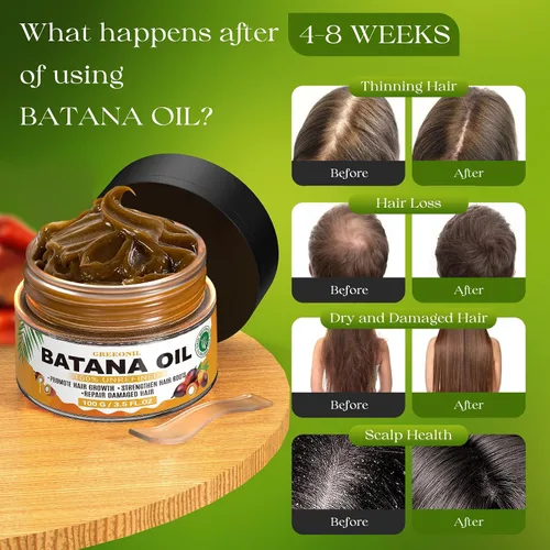 Miniatura 4 de GREEONIL Aceite de batana para el crecimiento del cabello, 100 % puro, prensado en frío, tratamiento orgánico para el cabello y cuero cabelludo