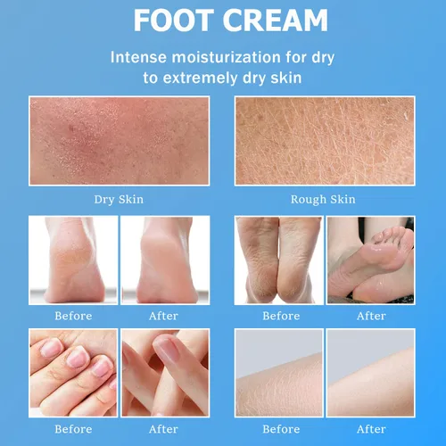 Miniatura 2 de Crema de urea 60% – Crema de pies de urea con calcetines hidratantes para el talón para manos secas agrietadas, 60 por ciento para pies de máxima