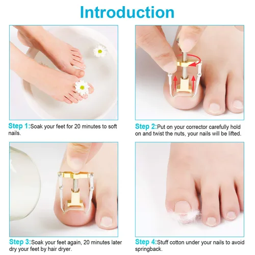 Miniatura 5 de 2 piezas encarnadas levantador de uñas encarnadas herramienta de uñas encarnadas abrazadera del dedo del pie de acero inoxidable herramienta