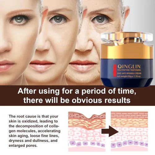 Miniatura 4 de Qinglin Crema facial, crema para arrugas, crema para eliminar arrugas, polipéptido tensante y crema antiarrugas para mujeres y hombres (2)