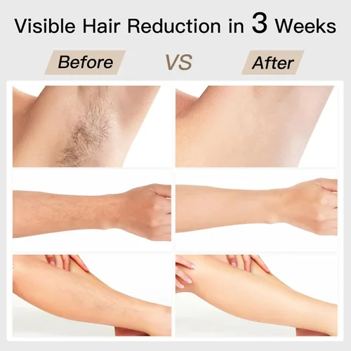 Miniatura 7 de Depilación láser, BoSidin depilación IPL con enfriamiento de hielo sin dolor, rejuvenecimiento facial SR 2 en 1, 6+1 modos, 6 niveles de depilación