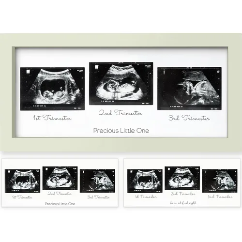 Miniatura 14 de KeaBabies Marco de Fotos de Ecografía para Bebé - Marcos Modernos de Fotos de Ultrasonido para Futuras Mamás, Regalos de Primer Embarazo para Mamá