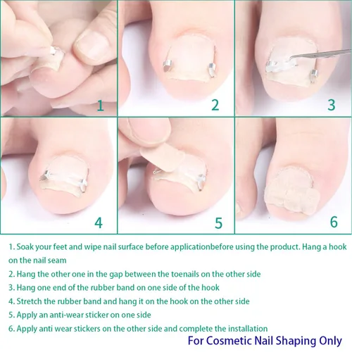 Miniatura 4 de Kit de corrección de uñas encarnadas, herramientas profesionales para el cuidado de uñas con clips de corrección y almohadillas adhesivas, cuatro