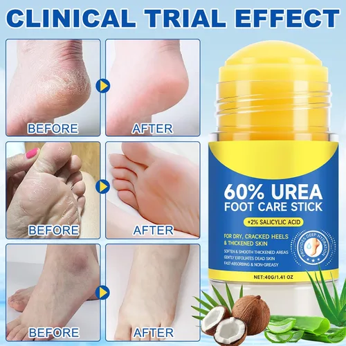 Miniatura 5 de Crema para pies 60% urea en barra con 2% de ácido salicílico, barra de cuidado de pies de urea y crema - Hidratante para piel seca y agrietada