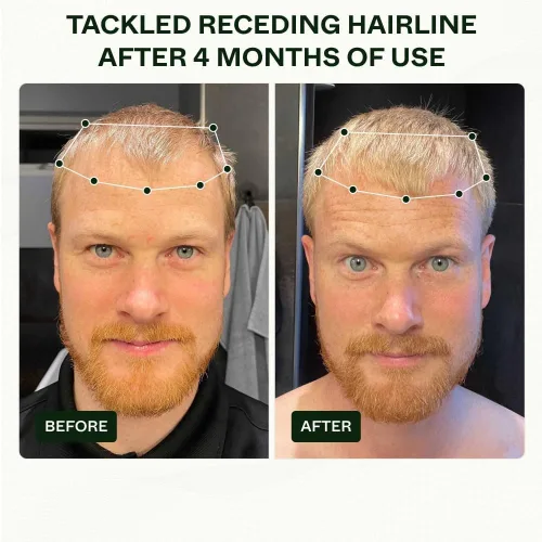 Miniatura 3 de Scandinavian Biolabs Rutina Bio-Pilixin® para hombres Ayuda con el desprendimiento del cabello, nutre los folículos pilosos, mejora la fuerza