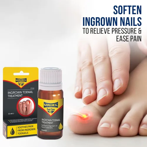 Miniatura 3 de Meditex Uriel Gotas para uñas de los pies encarnadas
