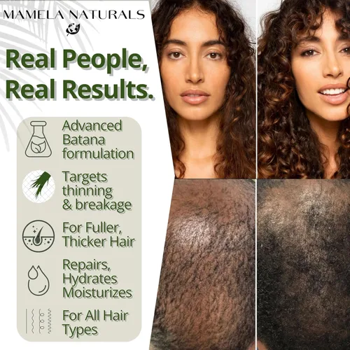Miniatura 6 de Mamela Naturals Aceite de batana para el crecimiento del cabello, mezcla 100% pura y natural con romero crudo y orgánico, almendra, aceite de menta