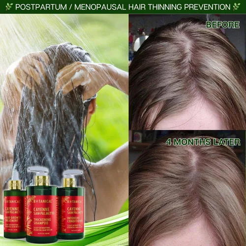 Miniatura 5 de Acondicionador botánico para el crecimiento del cabello, "desintoxicación del cuero cabelludo", terapia intensiva contra la pérdida de cabello