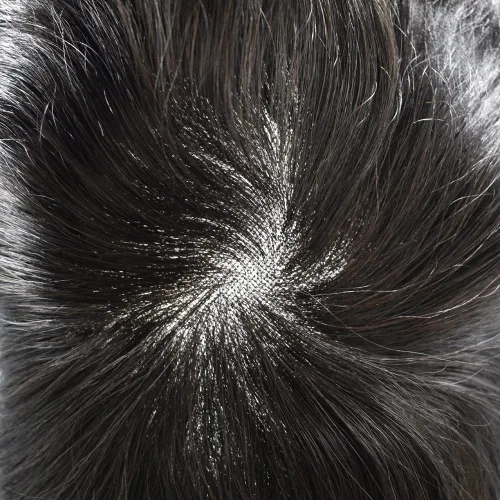 Miniatura 5 de Toupee para hombres piezas de cabello suave suizo frente de encaje para hombre Toupee sistema de reemplazo de cabello humano para hombres Pieza