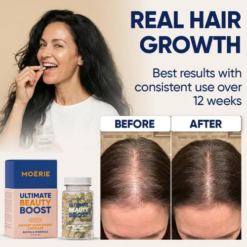 Miniatura 3 de Moerie Suplementos definitivos para el crecimiento del cabello para mujeres y hombres, para cabello, piel, uñas, vitaminas con biotina y minerales