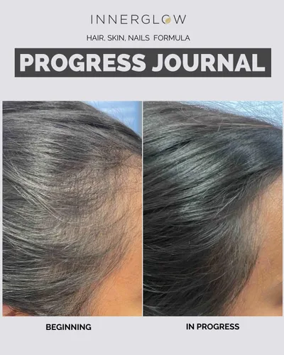 Miniatura 14 de Inner Glow Vitaminas Avanzadas para el Cabello, la Piel y las Uñas – Suplemento Capilar Desarrollado por Médicos con Biotina, Péptidos de Colágeno