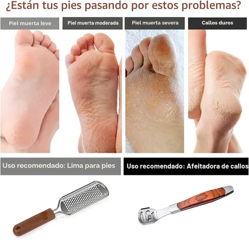 Miniatura 5 de Raspa de pie colosal y afeitadora de callos con mango de madera (10 cabezales de repuesto y 1 lima), kit de lima de pie de pedicura, raspador