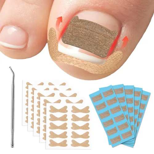 Miniatura 7 de FVION Juego de corrector de uñas encarnadas – 40 tiras alisadoras de uñas encarnadas sin dolor con levantador de uñas de los pies – Solución eficaz