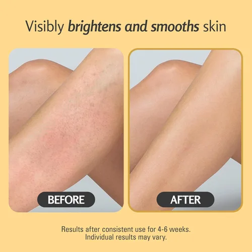 Miniatura 7 de Exfoliante de cúrcuma y exfoliante de piel con colágeno y aceite de coco, exfolia suavemente la cara, el cuerpo, las manos y los pies, cuidado