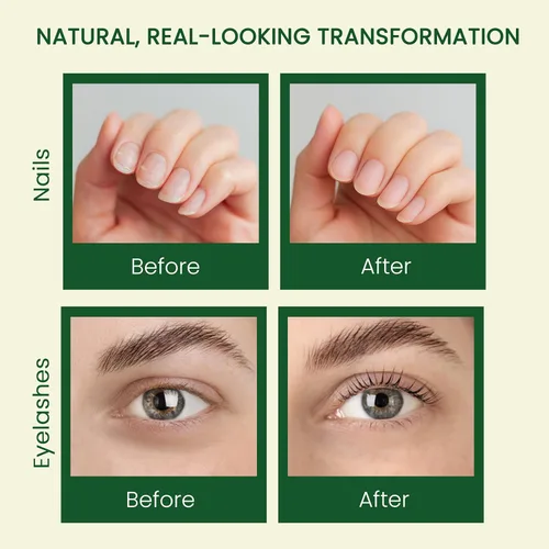 Miniatura 4 de Aceite de ricino puro (10 onzas), aceite de ricino 100% prensado en frío para el crecimiento del cabello, piel, cejas, pestañas de ojos, uñas