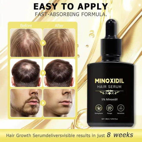 Miniatura 3 de 5% de crecimiento del cabello de minoxidil para hombres y mujeres, suero de crecimiento del cabello de minoxidil, promueve el crecimiento