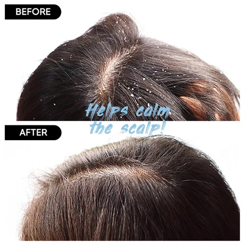 Miniatura 2 de Barra de Champú de Frijol Rojo MARS MADE 2.0 - Jabón Natural Hidratante y Humectante para el Color del Cabello y Nutrición del Cuero Cabelludo