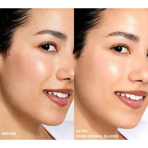 Miniatura 2 de Contours Rx Cuchillas dérmicas herramienta de retoque de acero inoxidable que elimina el vello facial peludo, línea de bikini, brazos, nudillos